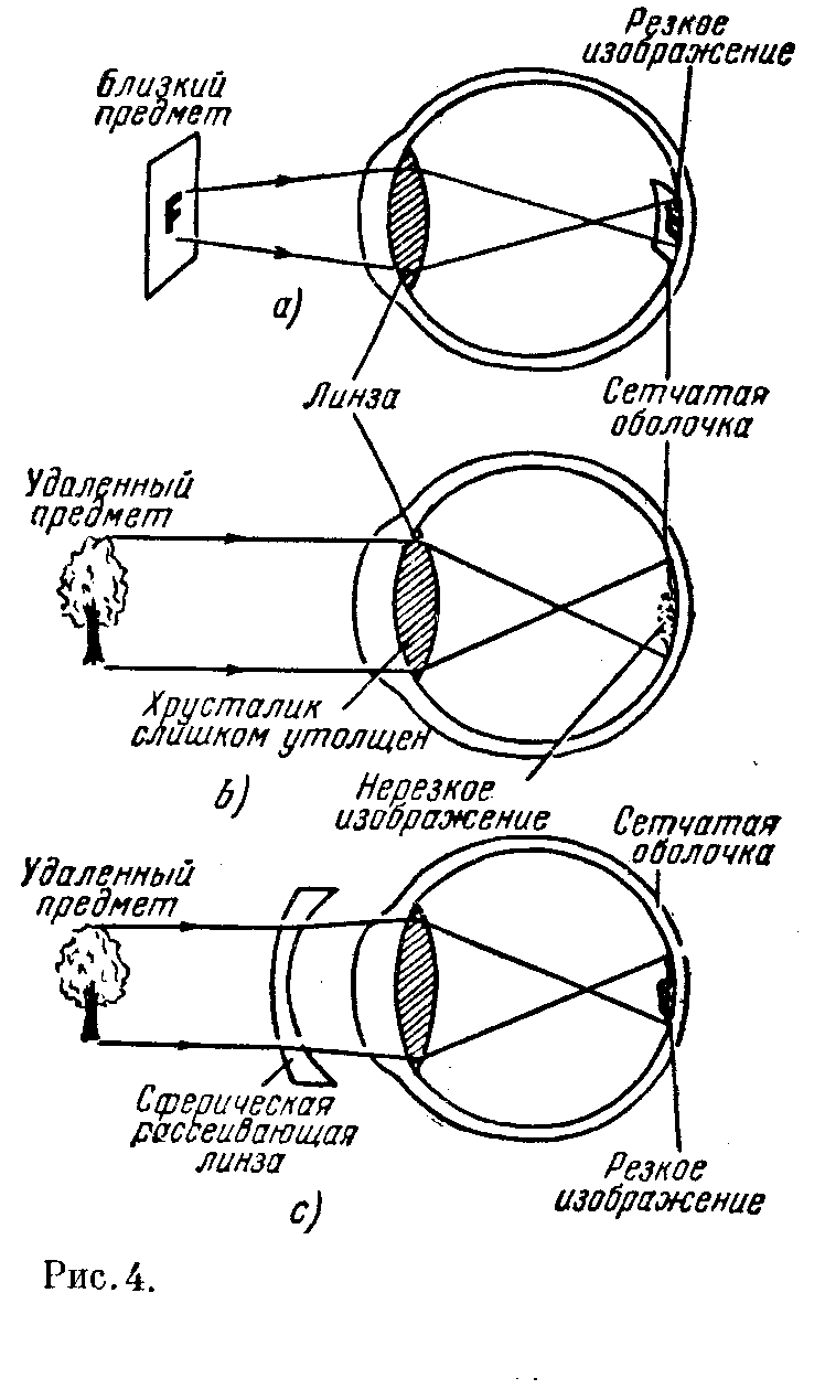 Оптика глаза (рис. 3) Оптика глаза (рис. 3)