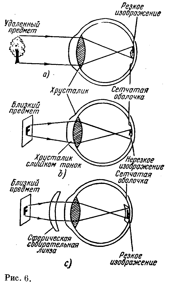 Оптика глаза (рис. 5) Оптика глаза (рис. 5)
