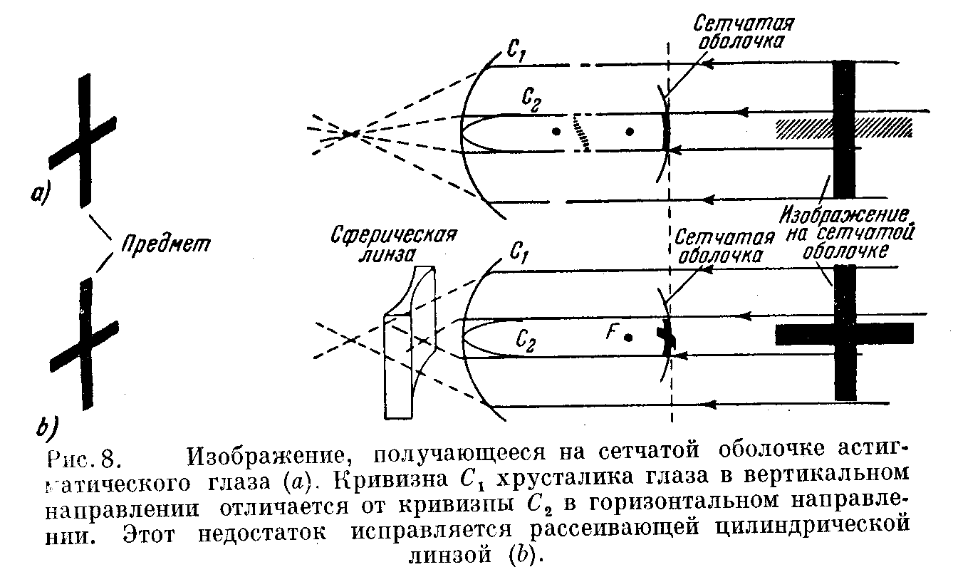 Оптика глаза (рис. 7) Оптика глаза (рис. 7)